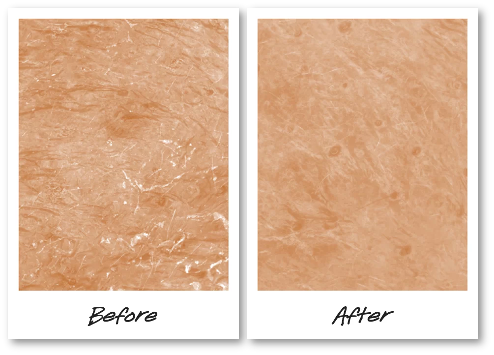Ultra Facial Barrier Balm - 5x stronger moisture barrier function